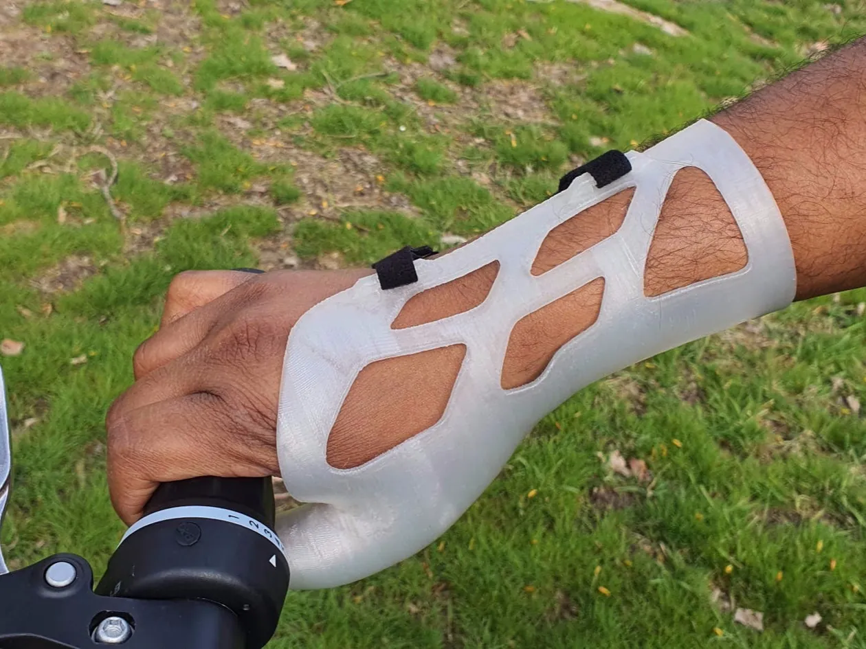 3D-gedruckte Orthimale mit Gitterstruktur am Unterarm einer Person beim Radfahren