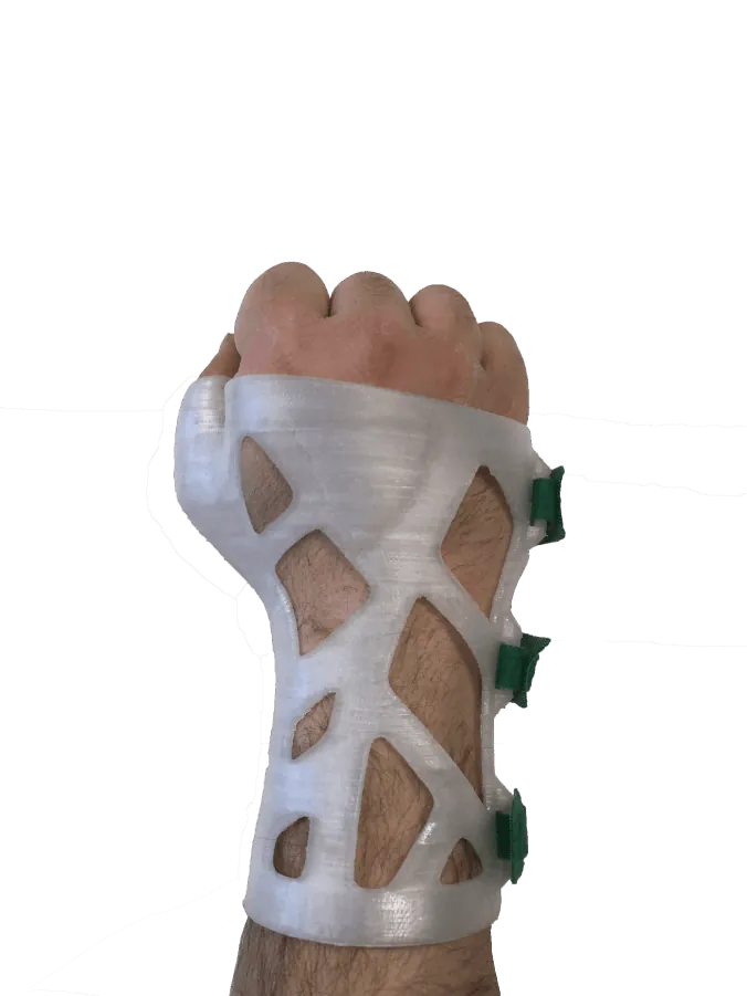 HN-Orthimale: kurze Handgelenksorthese mit Gitterstruktur, an der Hand getragen