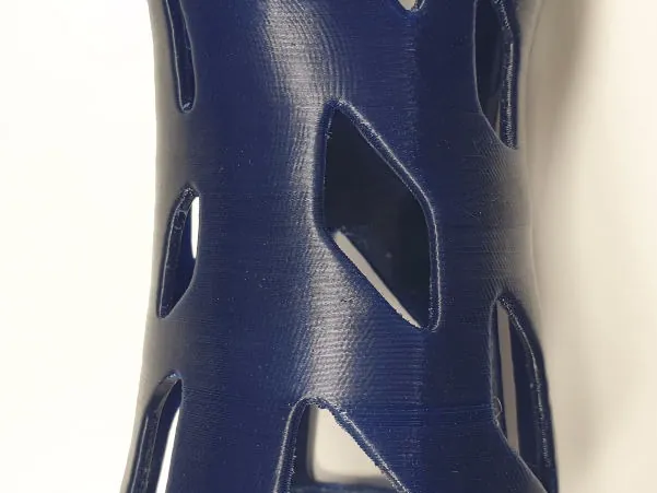 Blaue 3D-gedruckte Orthese aus thermoplastischem Polyurethan (TPU)